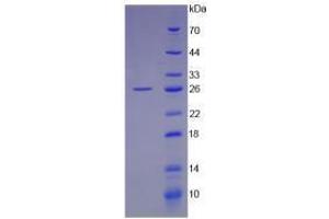 Image no. 2 for Leukemia Inhibitory Factor (LIF) (AA 2-201) (Active) protein (His tag) (ABIN6239785) (LIF Protein (AA 2-201) (His tag))