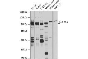 Western blot analysis of extracts of various cell lines, using IL5RA antibody (ABIN6132076, ABIN6142402, ABIN6142403 and ABIN6224648) at 1:1000 dilution. (IL5RA antibody  (AA 20-335))