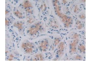IHC-P analysis of Human Stomach Tissue, with DAB staining. (GDF6 antibody  (AA 336-455))