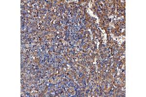 IHC analysis of Kindlin 2/FERMT2 using anti-Kindlin 2/FERMT2 antibody (ABIN7599515). (FERMT2 antibody  (AA 1-650))