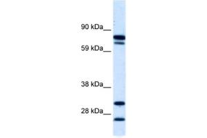 Western Blotting (WB) image for anti-Zinc Finger Protein 606 (ZNF606) antibody (ABIN2460763) (ZNF606 antibody)