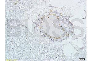 Formalin-fixed and paraffin embedded human brain tissue labeled with Rabbit Anti-ER-Beta Polyclonal Antibody, Unconjugated (ABIN726905) at 1:200 followed by conjugation to the secondary antibody and DAB staining. (ESR2 antibody  (AA 50-100))