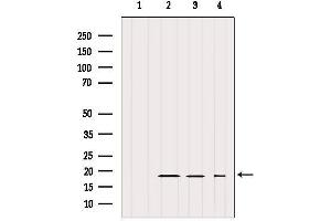 Western blot analysis of extracts from various samples, using IFT20 Antibody. (IFT20 antibody)