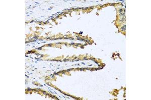 Immunohistochemistry of paraffin-embedded human prostate using GNRH1 antibody at dilution of 1:100 (40x lens). (GNRH1 antibody)