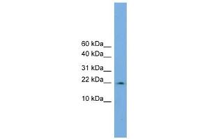 WB Suggested Anti-PPIL3 Antibody Titration:  0. (PPIL3 antibody  (Middle Region))