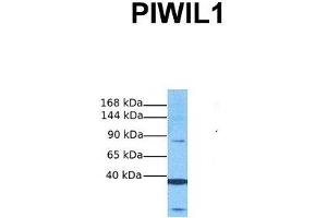 Host:  Rabbit  Target Name:  PIWIL1  Sample Tissue:  Human Fetal Liver  Antibody Dilution:  1. (PIWIL1 antibody  (Middle Region))