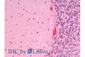 SLC7A6 antibody  (C-Term)