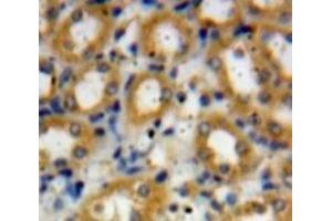 #VALUE! (C4A antibody  (AA 680-756))