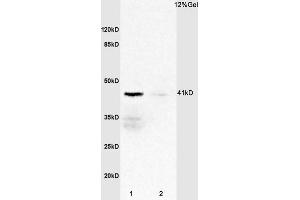 L1 rat spleen lysates L2 mouse heart lysates probed with Anti IL-2R gamma/CD132 Polyclonal Antibody, Unconjugated  at 1:3000 for 90 min at 37˚C. (IL2RG antibody  (AA 51-150))