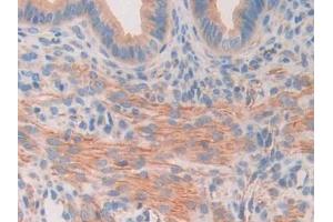 Detection of MAOA in Mouse Uterus Tissue using Polyclonal Antibody to Monoamine Oxidase A (MAOA)