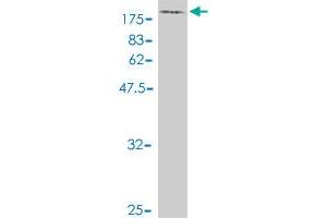 Western Blot detection against Immunogen (100. (KIF2A antibody  (AA 1-679))