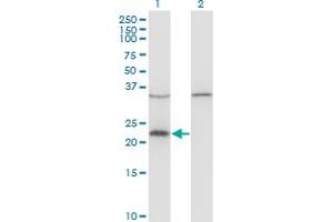 Western Blot analysis of VAX1 expression in transfected 293T cell line by VAX1 monoclonal antibody (M03), clone 2F4. (VAX1 antibody  (AA 1-100))