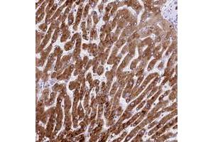 Immunohistochemical staining of human liver with RDH16 polyclonal antibody  shows strong cytoplasmic positivity in hepatocytes at 1:50-1:200 dilution. (RDH16 antibody)