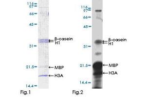 Kinase Activity Assay (KAA) image for Calcium/calmodulin-Dependent Protein Kinase IV (CAMK4) (AA 1-473) protein (GST tag) (ABIN1347939) (CAMK4 Protein (AA 1-473) (GST tag))