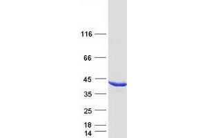 Validation with Western Blot (AKR1C4 Protein (Myc-DYKDDDDK Tag))
