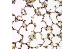 Immunohistochemistry of paraffin-embedded mouse lung using E2F6 antibody.