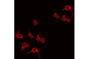 ABIN6274438 staining Hela by IF/ICC. (LMO3 antibody  (C-Term))