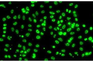 Immunofluorescence analysis of A549 cells using CSRNP1 Polyclonal Antibody (AXUD1 antibody)