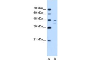 Western Blotting (WB) image for anti-Fumarylacetoacetate Hydrolase (Fumarylacetoacetase) (FAH) antibody (ABIN2462451)