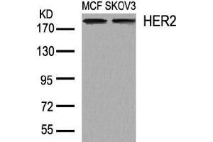 Image no. 2 for anti-Receptor tyrosine-protein kinase erbB-2 (ErbB2/Her2) (AA 1246-1250) antibody (ABIN197227) (ErbB2/Her2 antibody  (AA 1246-1250))