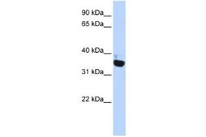 Western Blotting (WB) image for anti-Olfactory Receptor, Family 13, Subfamily C, Member 5 (OR13C5) antibody (ABIN2457933)