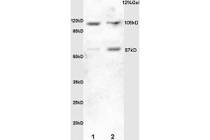 Lane 1: mouse embryo lysates Lane 2:rat brain lysates probed with Anti HSF1 Polyclonal Antibody, Unconjugated (ABIN703676) at 1:200 in 4 °C. (HSF1 antibody  (AA 351-450))