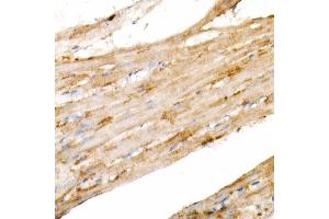 Immunohistochemistry of paraffin-embedded rat heart using PGC1α Rabbit mAb  at dilution of 1:1000 (40x lens). (PPARGC1A antibody)