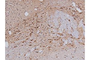 ABIN6267326 at 1/200 staining Rat brain tissue sections by IHC-P. (Tyrosine Hydroxylase antibody  (pSer40))