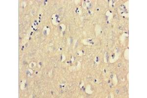 Immunohistochemistry of paraffin-embedded human brain tissue using ABIN7147334 at dilution of 1:100 (CNBP antibody  (AA 2-170))