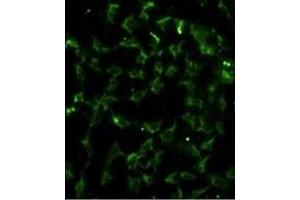 Immunofluorescence analysis of CA9 Antibody (Center) with hela cells. (CA9 antibody  (AA 113-143))