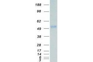 Western Blotting (WB) image for Mitogen-Activated Protein Kinase 10 (MAPK10) (Transcript Variant 1) protein (Myc-DYKDDDDK Tag) (ABIN2725409)