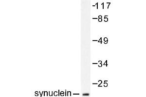 Image no. 1 for anti-Synuclein, alpha (SNCA) antibody (ABIN271837) (SNCA antibody)