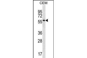 MOSPD2 Antibody (N-term ) (ABIN657246 and ABIN2846344) western blot analysis in CEM cell line lysates (35 μg/lane). (MOSPD2 antibody  (N-Term))