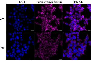 anti-Transmembrane Protein 43 (TMEM43) antibody