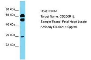 Image no. 1 for anti-CD200 Receptor 1-Like (CD200R1L) (AA 87-136) antibody (ABIN6750795) (CD200R1L antibody  (AA 87-136))