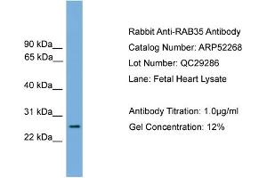 WB Suggested Anti-RAB35  Antibody Titration: 0. (RAB35 antibody  (Middle Region))