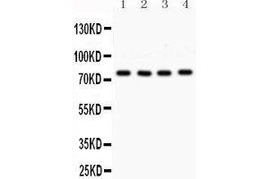 Western Blotting (WB) image for anti-Protein Kinase C, alpha (PKCa) (AA 153-342) antibody (ABIN3043549) (PKC alpha antibody  (AA 153-342))