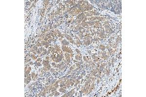 IHC analysis of SNPH using anti-SNPH antibody (ABIN7601724). (Syntaphilin antibody  (AA 43-482))