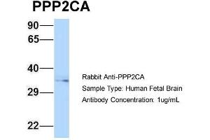 Host: Rabbit  Target Name: PPP2CA  Sample Tissue: Human Fetal Brain  Antibody Dilution: 1. (PPP2CA antibody  (N-Term))