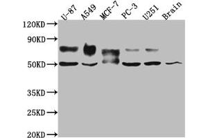 Western Blot Positive WB detected in: U-87 whole cell lysate, A549 whole cell lysate, MCF-7 whole cell lysate, PC-3 whole cell lysate, U-251 whole cell lysate, Mouse Brain whole cell lysate All lanes: 5T4 antibody at 1:1000 Secondary Goat polyclonal to rabbit IgG at 1/50000 dilution Predicted band size: 47 kDa Observed band size: 50, 80 kDa (Recombinant TPBG antibody)
