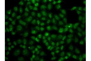 Immunofluorescence analysis of A549 cells using USP26 antibody. (USP26 antibody  (AA 664-913))