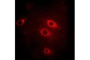 Immunofluorescent analysis of 14-3-3 beta staining in Hela cells. (YWHAB antibody)