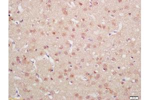 Formalin-fixed and paraffin embedded rat brain labeled with Rabbit Anti-MDM2(Ser186) Polyclonal Antibody, Unconjugated  at 1:200 followed by conjugation to the secondary antibody and DAB staining (MDM2 antibody  (pSer186))