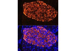 Immunofluorescence (IF) image for anti-Insulin (INS) (AA 1-110) antibody (ABIN3022885)