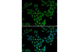 Immunofluorescence analysis of HeLa cells using ASF1A antibody (ABIN5973912). (ASF1A antibody)
