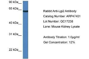 Western Blotting (WB) image for anti-Leucine-Rich Repeat LGI Family, Member 2 (LGI2) (Middle Region) antibody (ABIN2782947) (LGI2 antibody  (Middle Region))