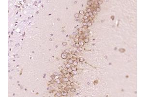 Paraformaldehyde-fixed, paraffin embedded rat brain; Antigen retrieval by boiling in sodium citrate buffer (pH6) for 15min; Block endogenous peroxidase by 3% hydrogen peroxide for 30 minutes; Blocking buffer (normal goat serum) at 37°C for 20min; Antibody incubation with PTPN5/STEP Polyclonal Antibody, Unconjugated (bs-11328R) at 1:200 overnight at 4°C, followed by a conjugated secondary and DAB staining. (PTPN5 antibody  (AA 201-300))