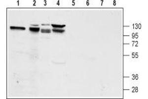 Western blot analysis of rat pancreas lysate (lanes 1 and 5), mouse preadipocyte 3T3-L1 lysate (lanes 2 and 6), rat pancreatic islet cell line RIN-5F lysate (lanes 3 and 7) and human pancreatic carcinoma PANC-1 lysate (lanes 4 and 8): - 1-4. (GLP1R antibody  (2nd Extracellular Loop))