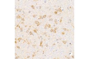 Immunohistochemistry of paraffin-embedded rat brain using eIF1A Rabbit mAb (ABIN7267027) at dilution of 1:50 (40x lens). (Eukaryotic Translation Initiation Factor 1A (EIF1A) antibody)