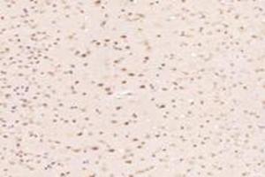 Immunohistochemistry (Paraffin-embedded Sections) (IHC (p)) image for anti-Mediator Complex Subunit 27 (MED27) antibody (ABIN7074581)